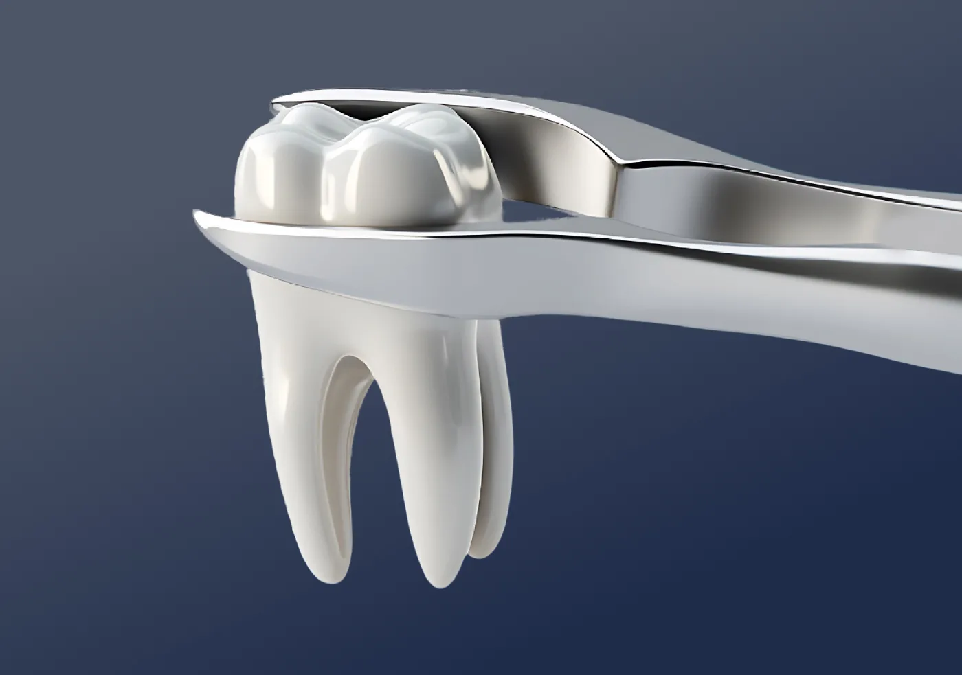 Tooth Extractions
