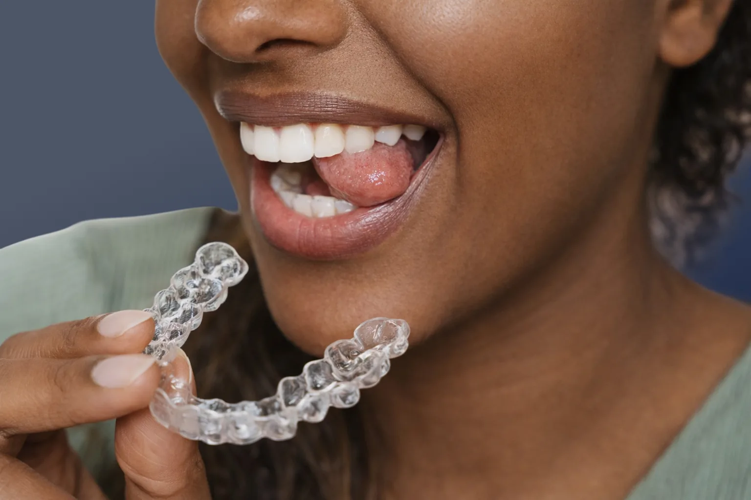 Clear Aligners