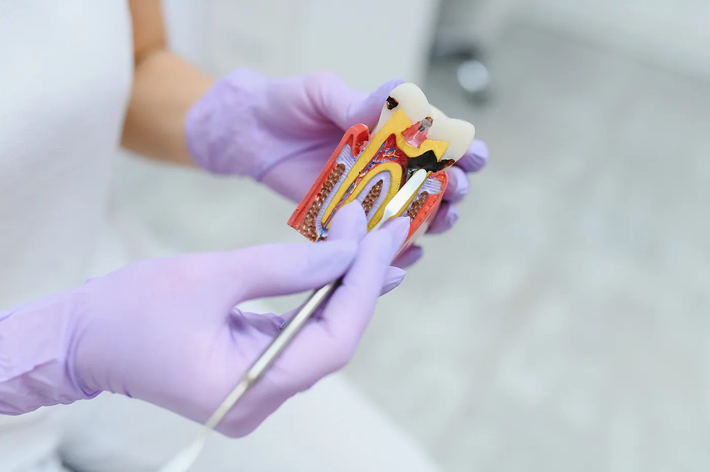 Endodontics (Root Canal Therapy)