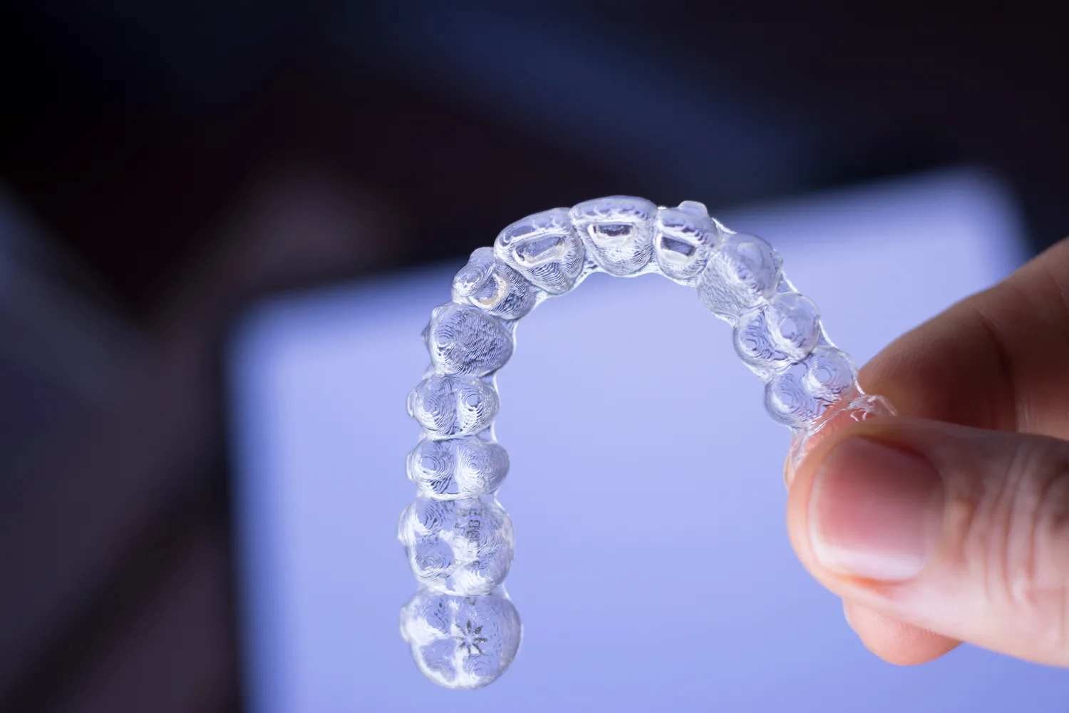 Orthodontics and Clear Aligners