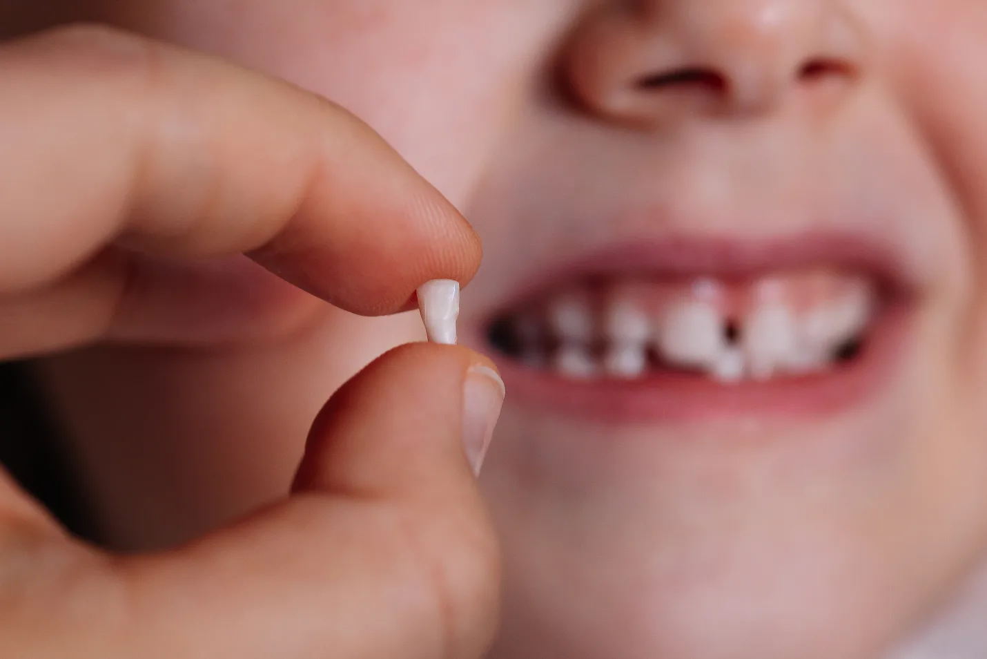 Knocked Out Baby Tooth