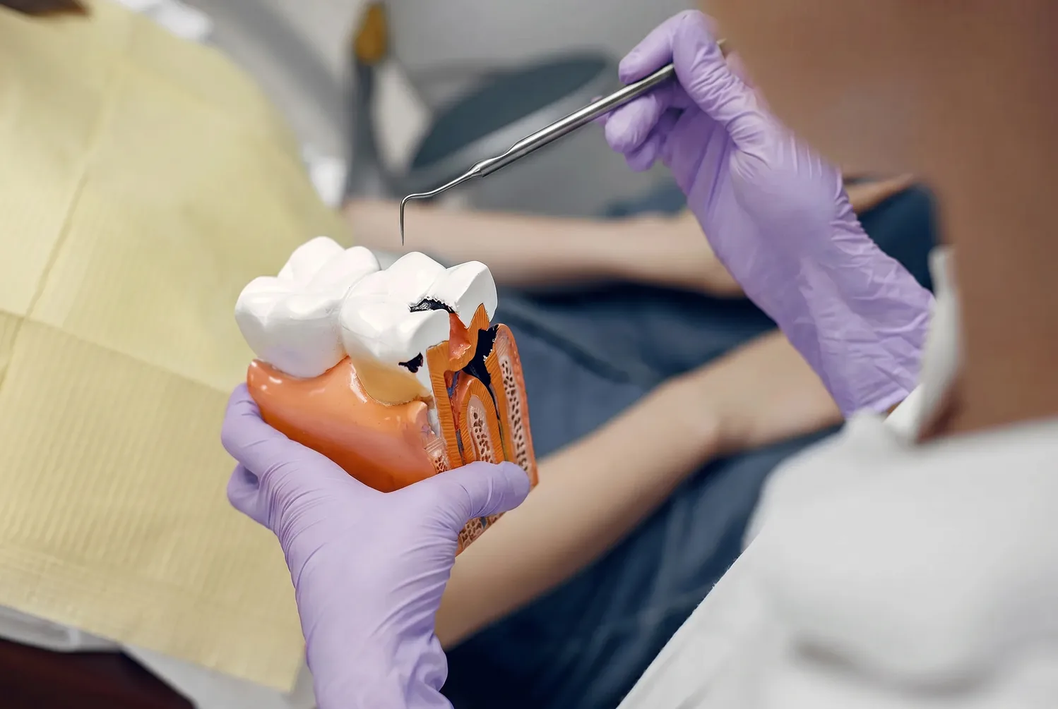 Root Canal Therapy