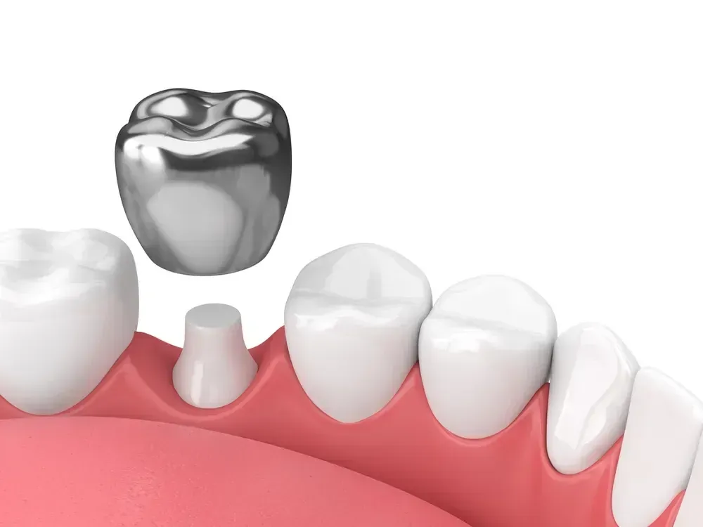 Stainless Steel Crowns